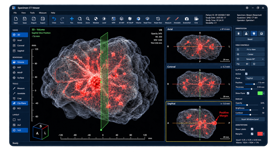 Concept mockup of the MarginX 3D specimen CT viewer software, showing volume rendering with axial, coronal, and sagittal margin views and a flagged positive margin